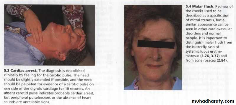 OSCE photos