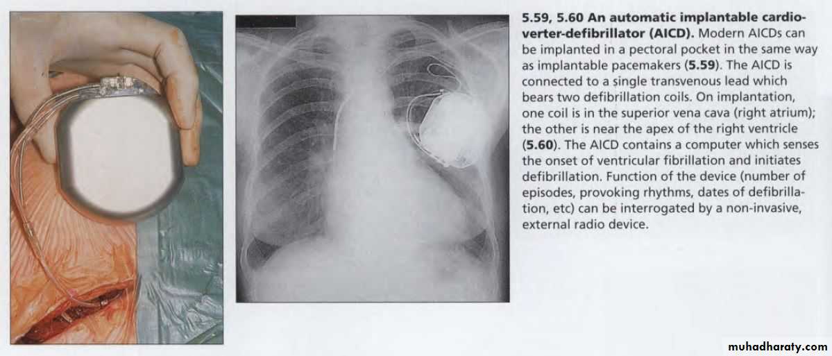 OSCE photos