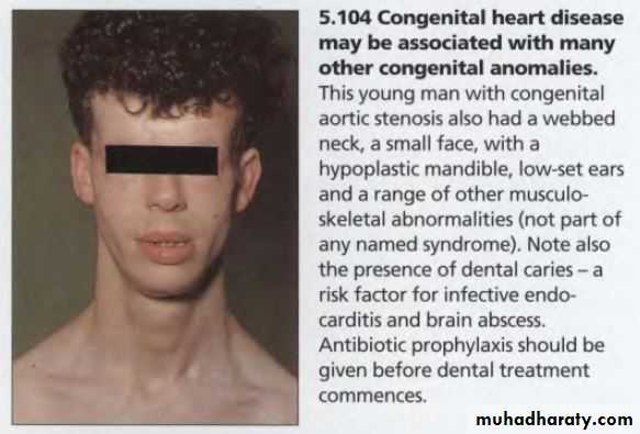 OSCE photos