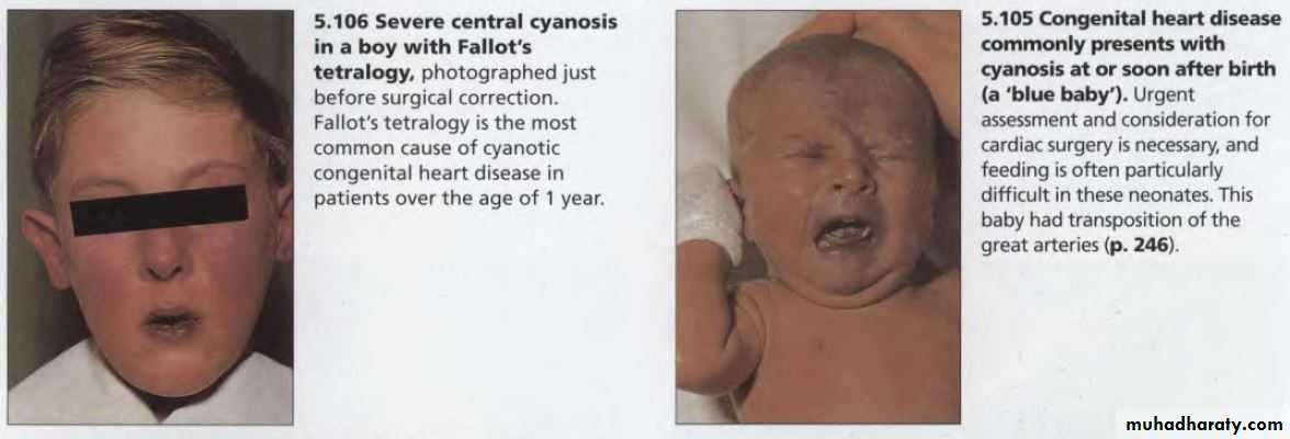 OSCE photos