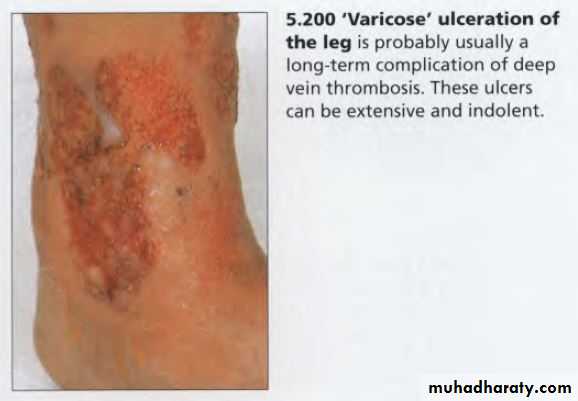 OSCE photos