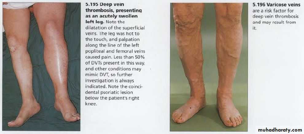 OSCE photos