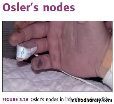OSCE photos