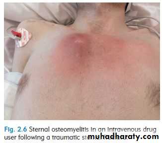 OSCE photos