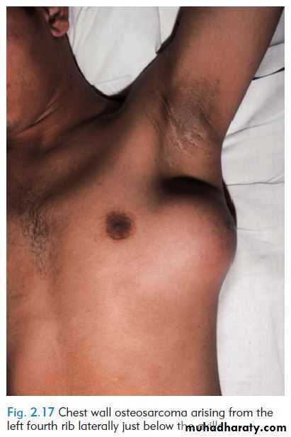 OSCE photos