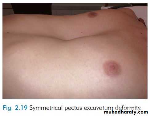 OSCE photos
