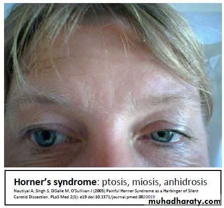 OSCE photos