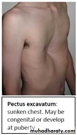 OSCE photos
