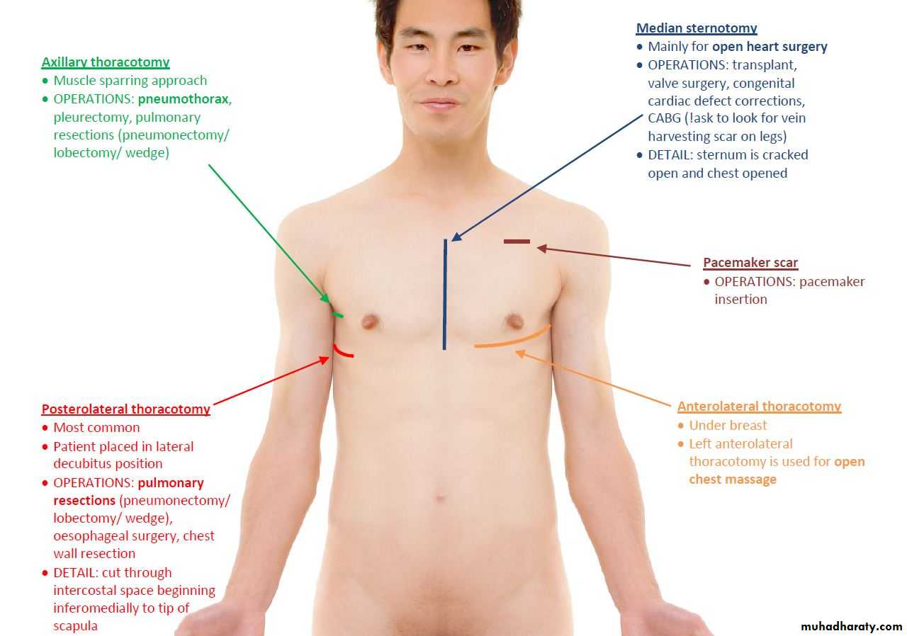 OSCE photos