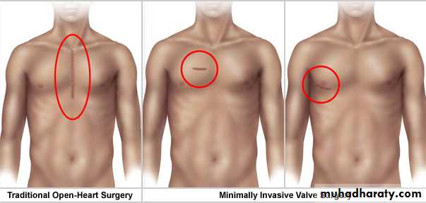 OSCE photos