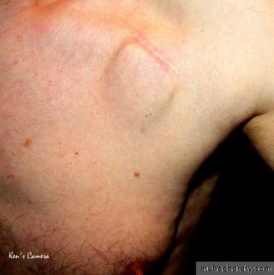 OSCE photos