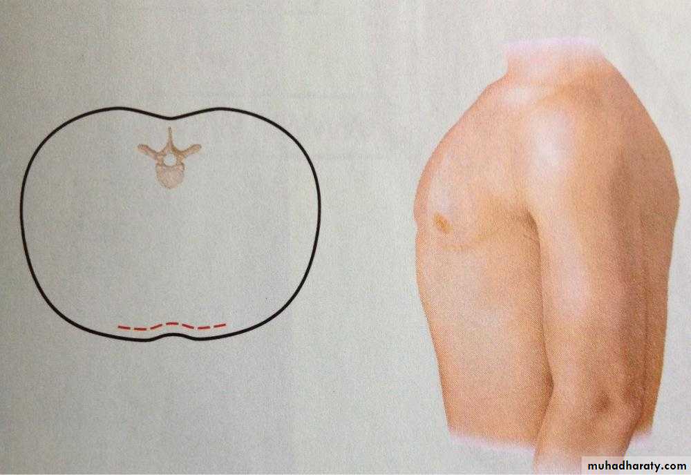 OSCE photos