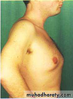 OSCE photos
