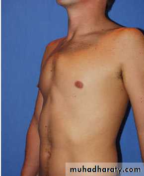 OSCE photos