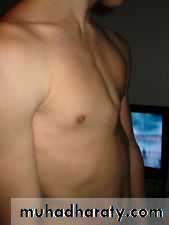 OSCE photos