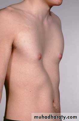 OSCE photos
