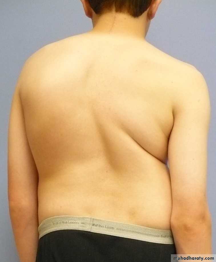 OSCE photos