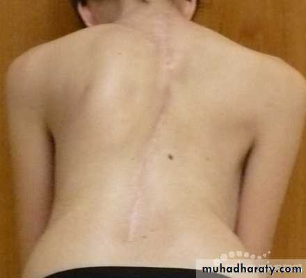 OSCE photos
