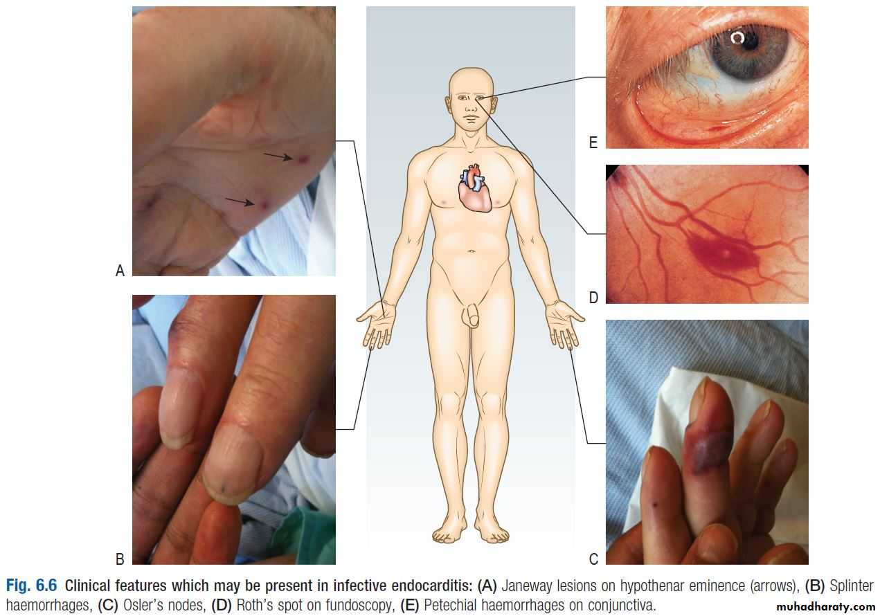 OSCE photos