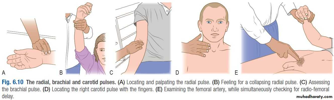 OSCE photos