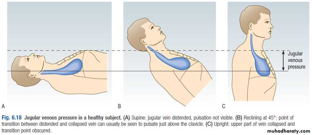 OSCE photos