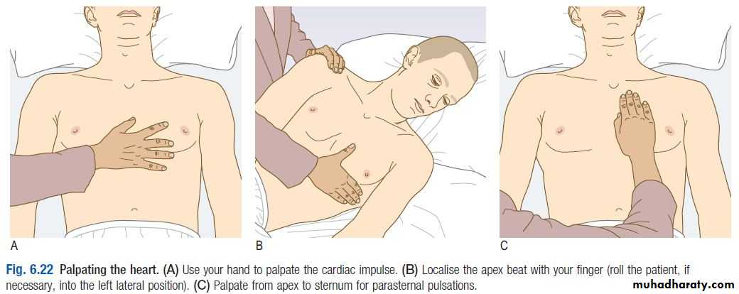 OSCE photos