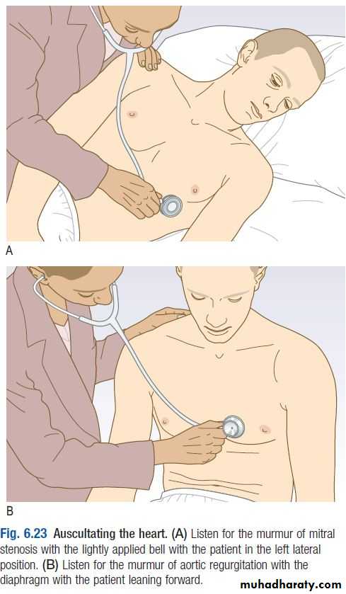 OSCE photos