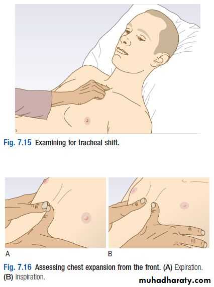 OSCE photos