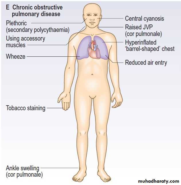 OSCE photos