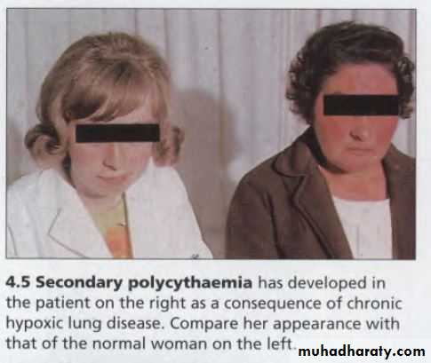 OSCE photos