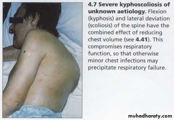 OSCE photos