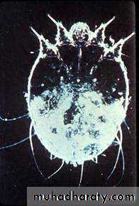 Scabies