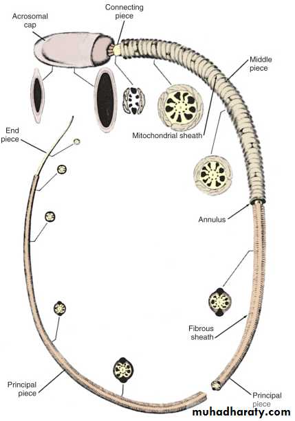 MALE INFERTILITY