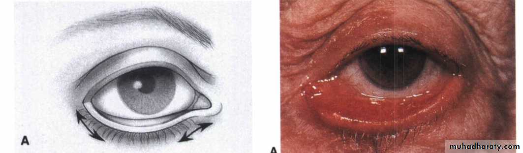 LACRIMAL SYSTEM
