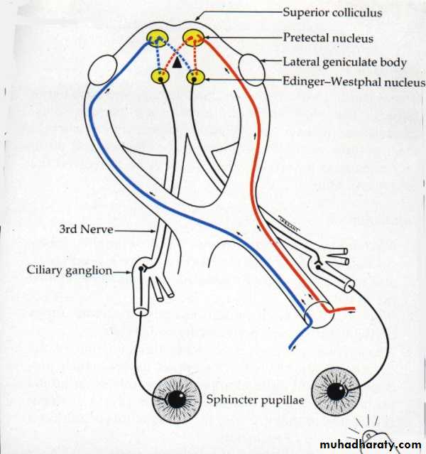 OPTIC NEUROPATHIES 2