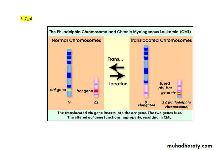 chronic myleoid leukaemia