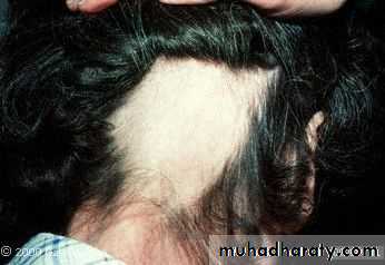 Diseases of the Hair