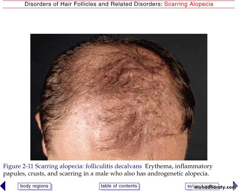 Diseases of the Hair