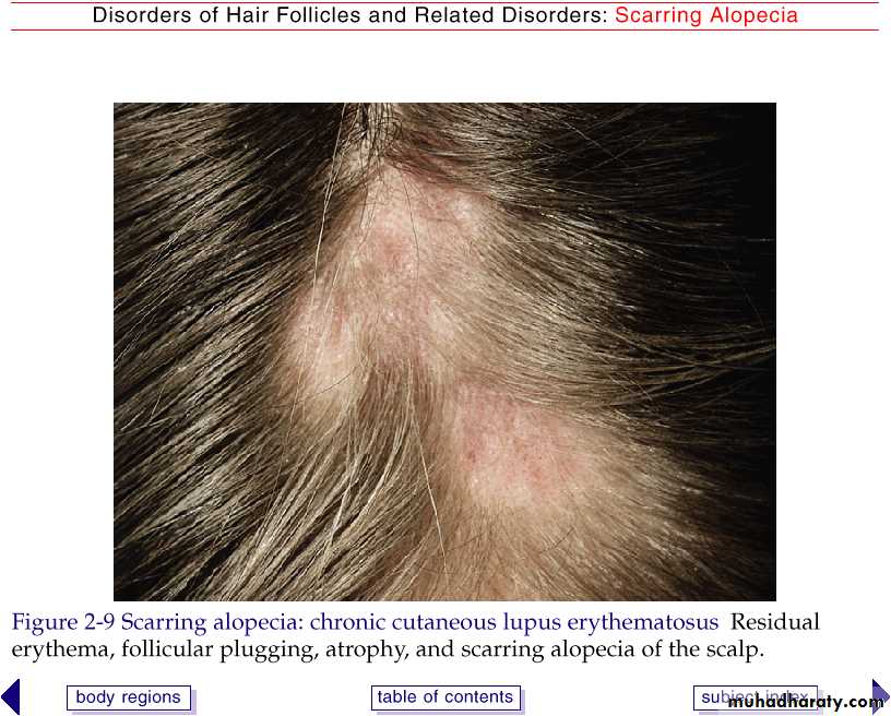 Diseases of the Hair