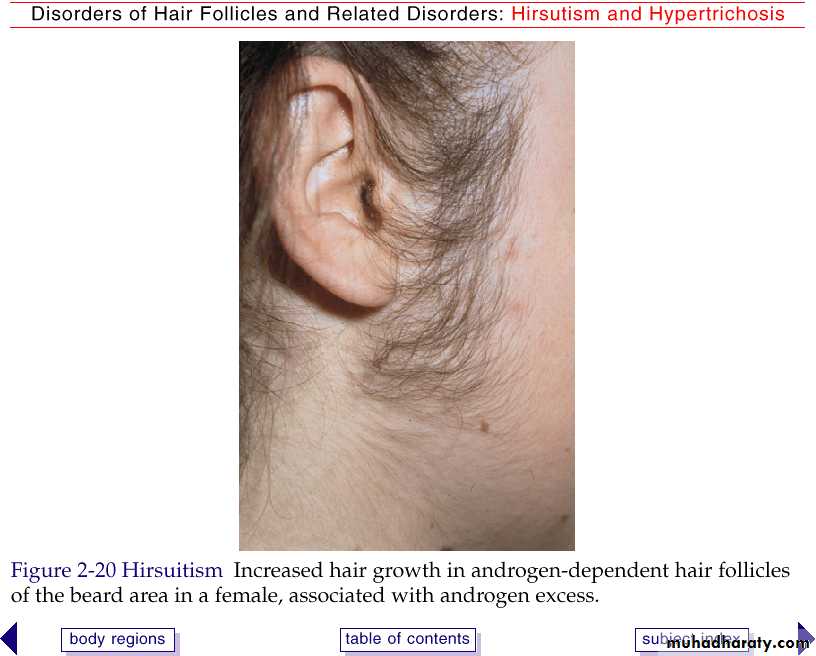 Diseases of the Hair