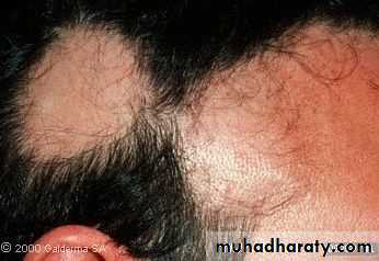 Diseases of the Hair