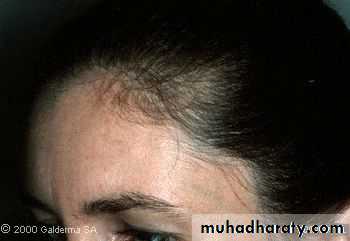 Diseases of the Hair