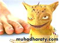 Fungal Infections