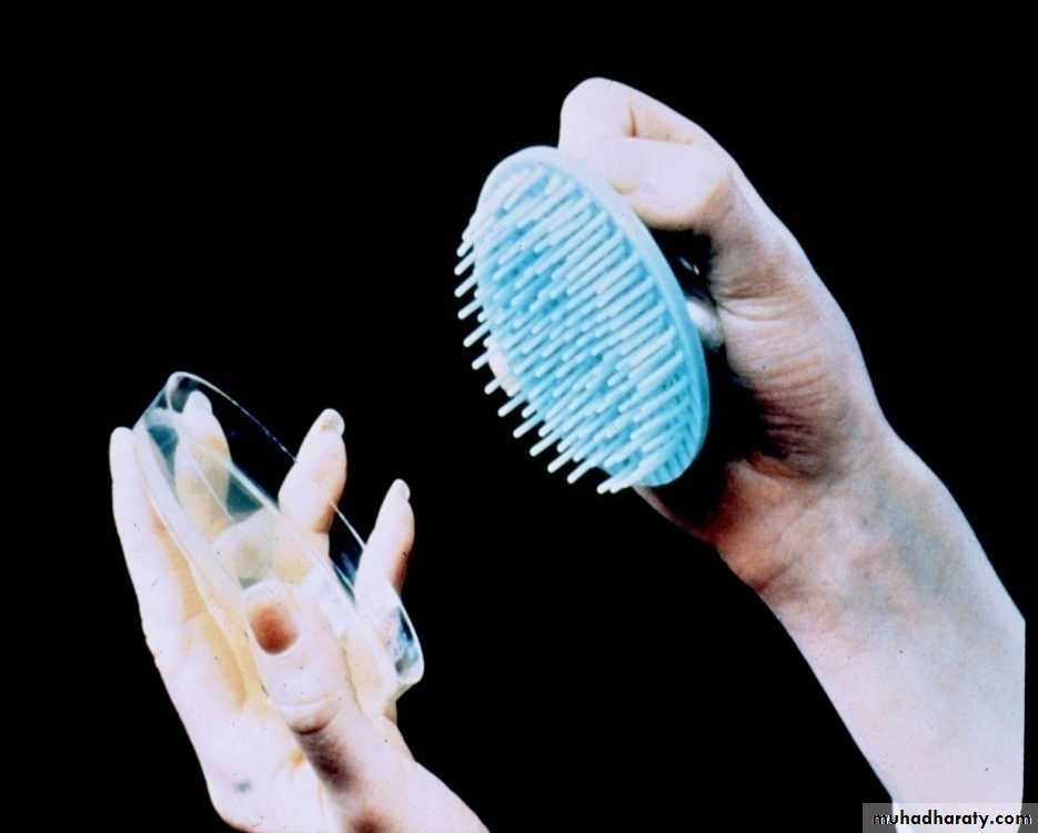 Fungal Infections