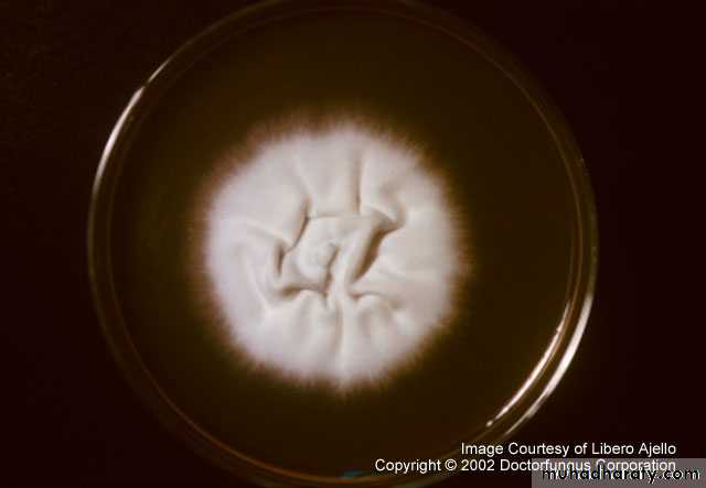 Fungal Infections