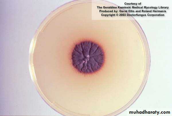 Fungal Infections