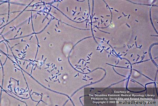 Fungal Infections