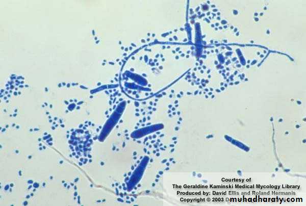 Fungal Infections