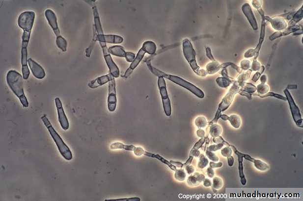Fungal Infections