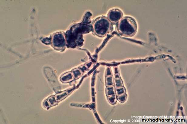 Fungal Infections